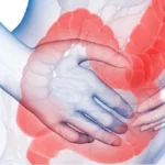 what is Irritable Bowel Disease and its management